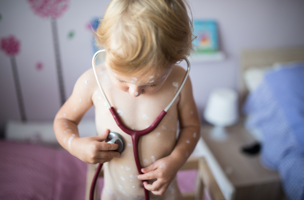 Little two year old girl at home sick with chickenpox, white antiseptic cream applied to the rash. Playing with stethoscope, listening to her heartbeat .