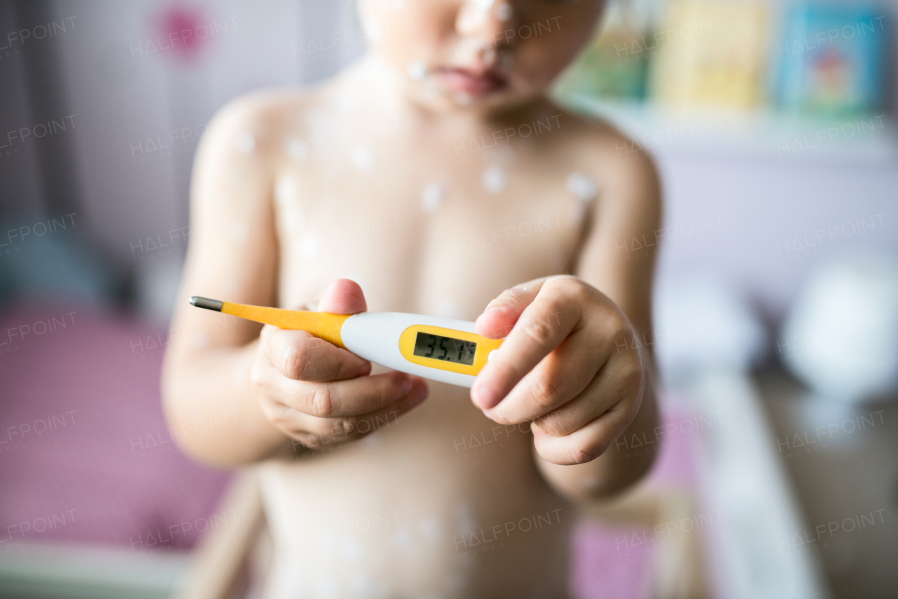 Unrecognizable little two year old girl at home sick with chickenpox, white antiseptic cream applied to the rash, holding thermometer, showing temperature. Close up.