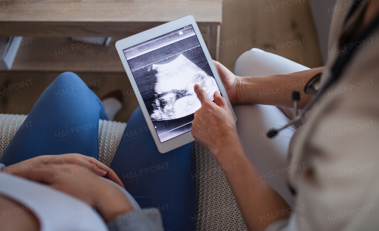 Unrecognizable healthcare worker with ultrasound on tablet and pregnant woman, top view.