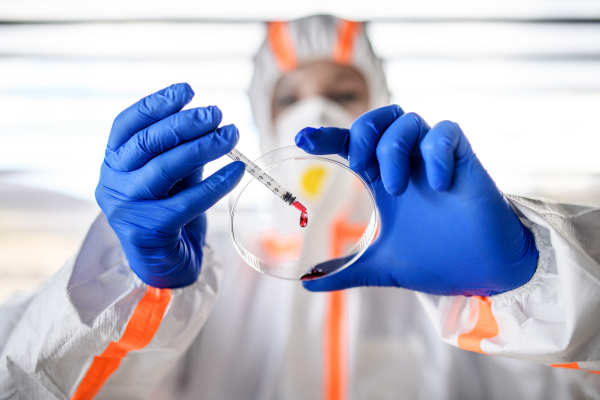 Doctor with protective suit and mask analyzing blood samples, coronavirus concept.