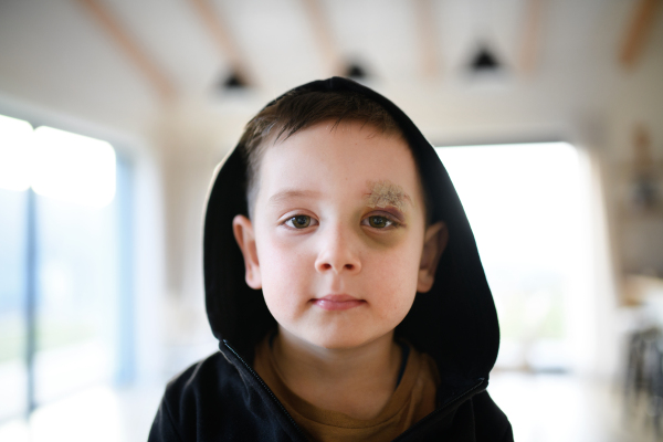 Poor sad small boy with cut eyebrow standing indoors at home, poverty concept. Shot through glass.