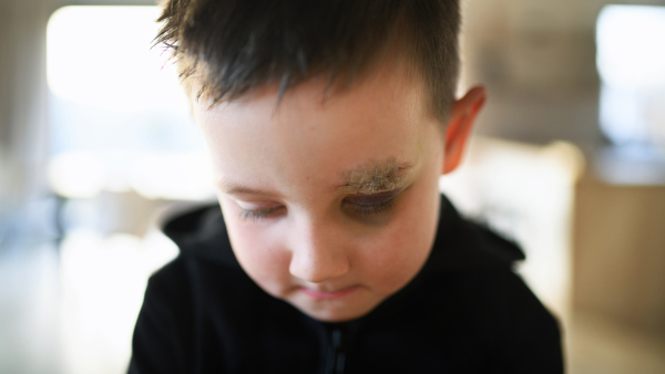 Poor sad small boy with cut eyebrow standing indoors at home, poverty concept. Shot through glass.