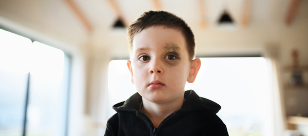 Poor sad small boy with cut eyebrow standing indoors at home, poverty concept. Shot through glass.