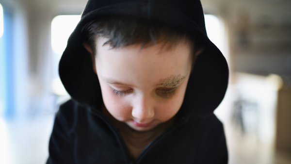 Poor sad small boy with cut eyebrow standing indoors at home, poverty concept. Shot through glass.