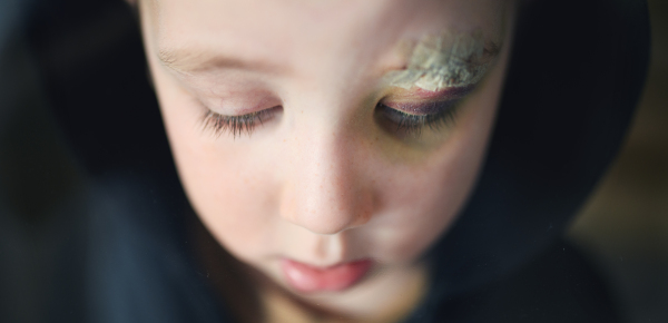 Close-up of sad small boy with cut eyebrow standing indoors at home, poverty concept. Shot through glass.