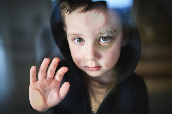 Poor sad small boy with cut eyebrow standing indoors at home, poverty concept. Shot through glass.