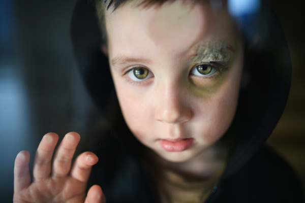 Poor sad small boy with cut eyebrow standing indoors at home, poverty concept. Shot through glass.