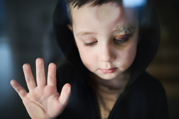 Poor sad small boy with cut eyebrow standing indoors at home, poverty concept. Shot through glass.