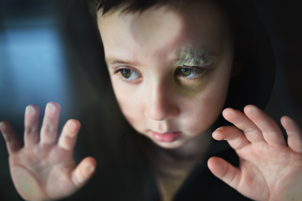 Poor sad small boy with cut eyebrow standing indoors at home, poverty concept. Shot through glass.