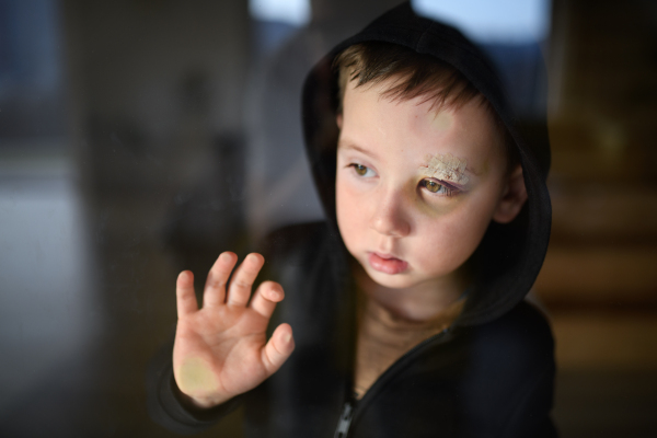 Poor sad small boy with cut eyebrow standing indoors at home, poverty concept. Shot through glass.