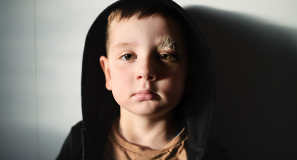 Poor sad small boy with cut eyebrow standing indoors at home, poverty concept. Shot through glass.