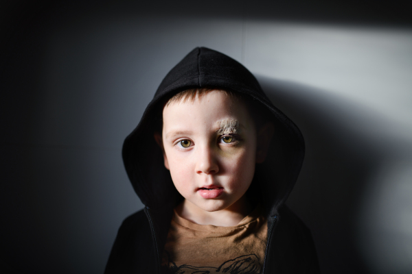 A poor sad small boy with cut eyebrow standing indoors at home, poverty concept.