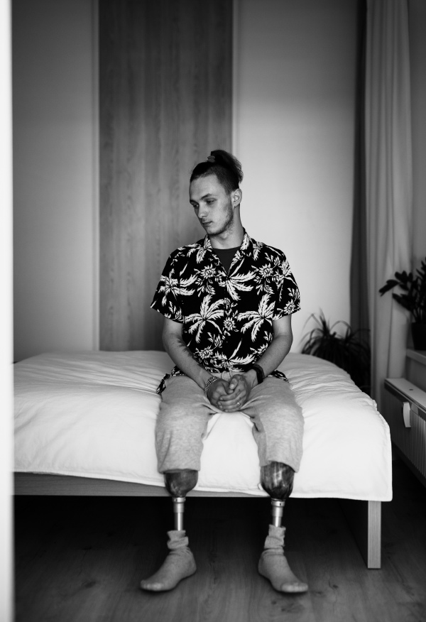 A black and white portrait of disabled young man sitting in bed indoors at home, leg prosthetic concept.