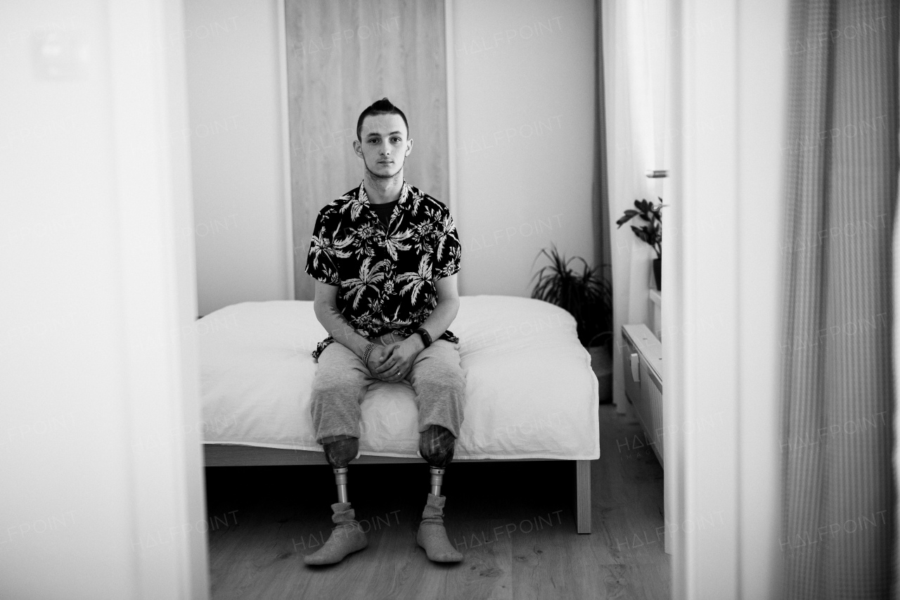 A black and white portrait of disabled young man sitting on bed indoors at home, leg prosthetic concept.