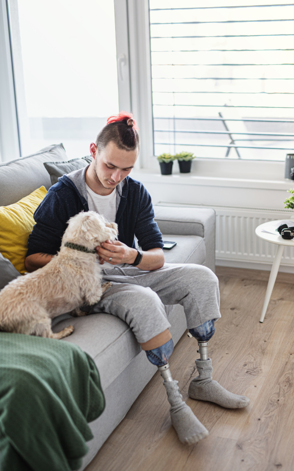 A portrait of disabled young man playing with dog indoors at home, leg prosthetic concept.