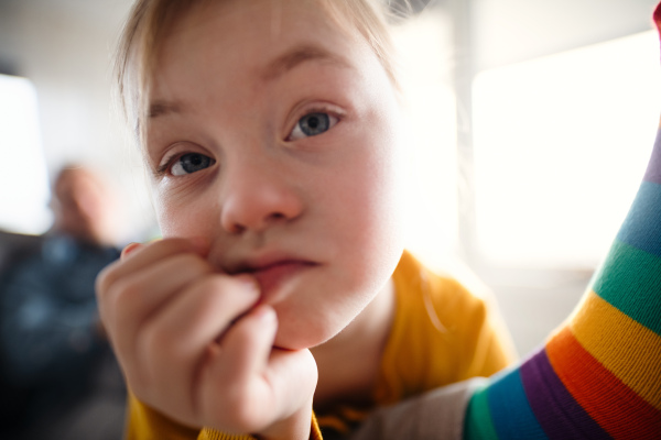 A close-up of sad little girl with Down syndrome lying on her father on bed and looking at camera.