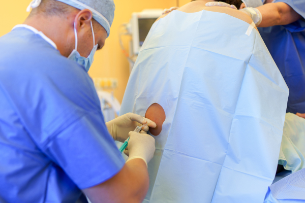 Spinal anesthesia before C-section. Anesthesiologist administering a dose of anesthetic near spinal cord, in the lower back.