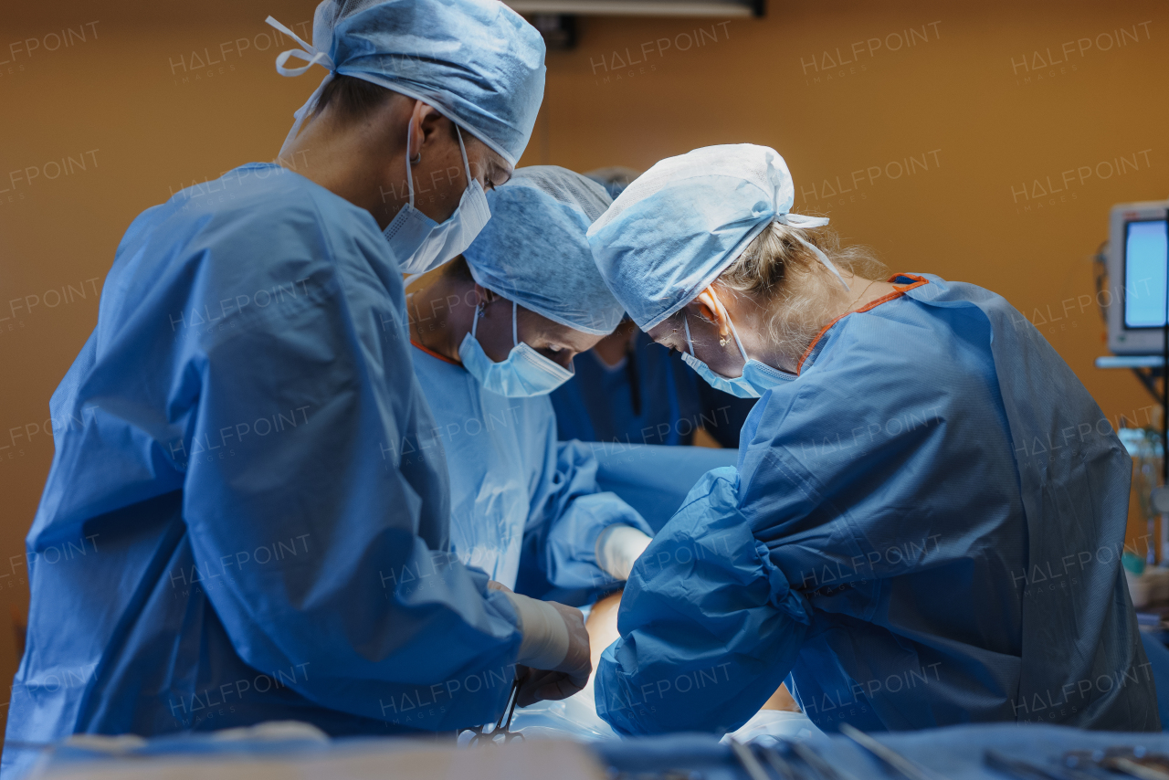 Team of doctors performing surgery in hospital. Medical team working together, operation.