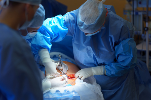 Abdominal surgery. Gynecologist, obstetricians and nurses as medical team during cesarean section delivery. Team of doctors performing surgery, operation. Modern Maternity hospital.