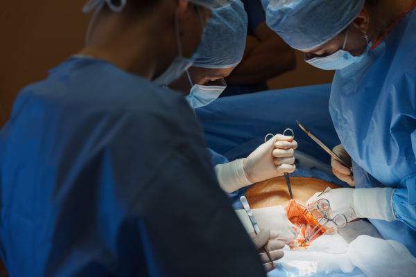 Abdominal surgery. Gynecologist, obstetricians and nurses as medical team during cesarean section delivery. Team of doctors performing surgery, operation. Modern Maternity hospital.