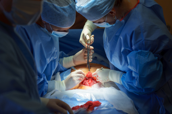 Abdominal surgery. Gynecologist, obstetricians and nurses as medical team during cesarean section delivery. Team of doctors performing surgery, operation. Modern Maternity hospital.