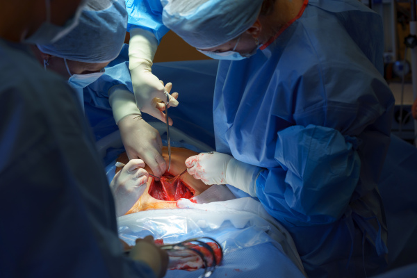 Abdominal surgery. Gynecologist, obstetricians and nurses as medical team during cesarean section delivery. Team of doctors performing surgery, operation. Modern Maternity hospital.