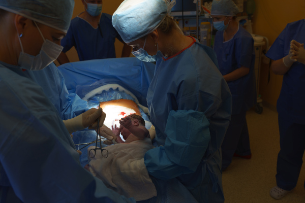 Delivery of baby by c-section. Gynecologist, obstetricians and nurses as medical team during cesarean childbirth. Team of doctors performing surgery, operation. Modern Maternity hospital.