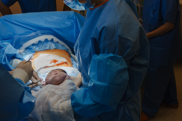 Delivery of baby by c-section. Gynecologist, obstetricians and nurses as medical team during cesarean childbirth. Team of doctors performing surgery, operation. Modern Maternity hospital.