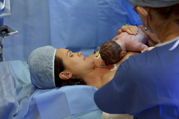 Mother bonding with newborn baby right after birth by c-section. Bonding on operating room. Skin to skin contact.