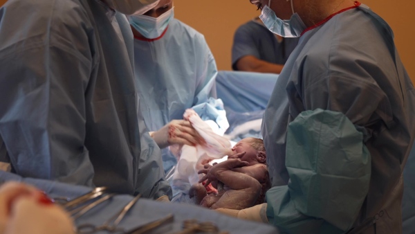 Delivery of baby by c-section. Gynecologist, obstetricians and nurses as medical team during cesarean childbirth. Team of doctors performing surgery, operation. Modern Maternity hospital.