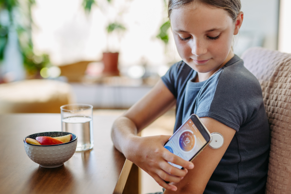 Girl with diabetes using continuous glucose monitor. Girl connecting CGM to a smartphone to monitor her blood sugar levels in real time.