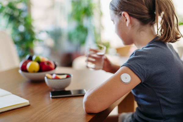 Close up of continuous glucose monitor sensor on girl's arm. Girl drinking water to better manage her diabetes.