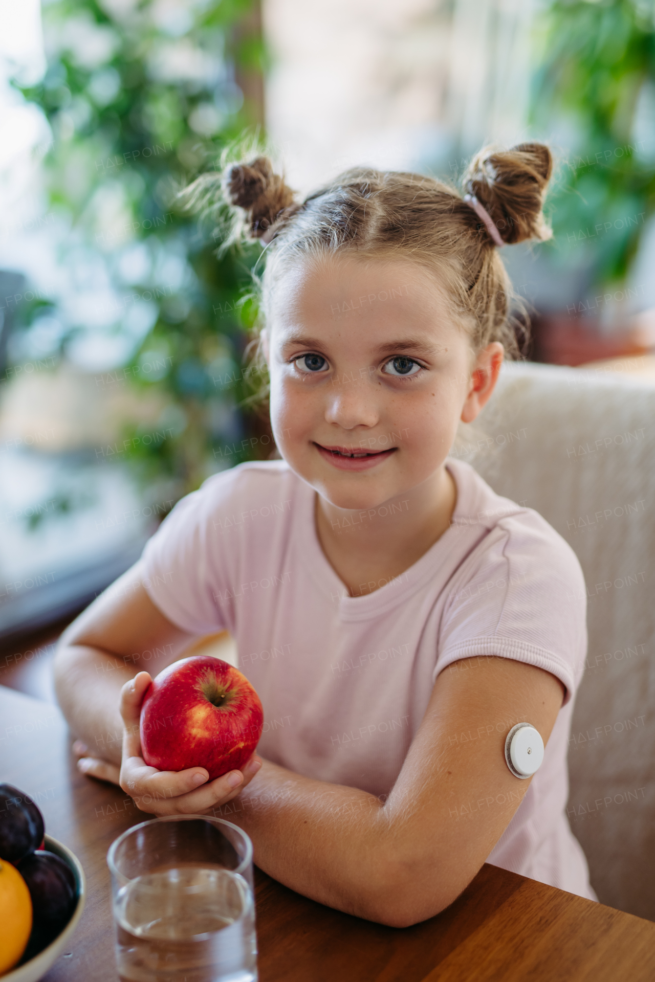 Portrait of diabetic girl with a continuous glucose monitor is careful with her diet. Apple causing a minimal rise in blood sugar level. CGM device making life of school girl easier, helping manage her illness and focus on other activities.