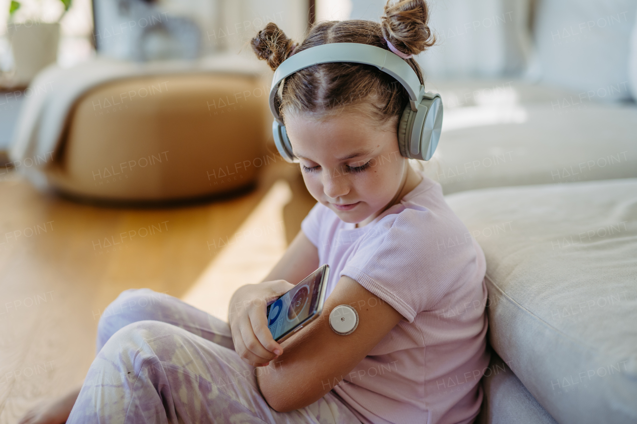 Girl with diabetes using continuous glucose monitor. Girl connecting CGM to a smartphone to monitor her blood sugar levels in real time.