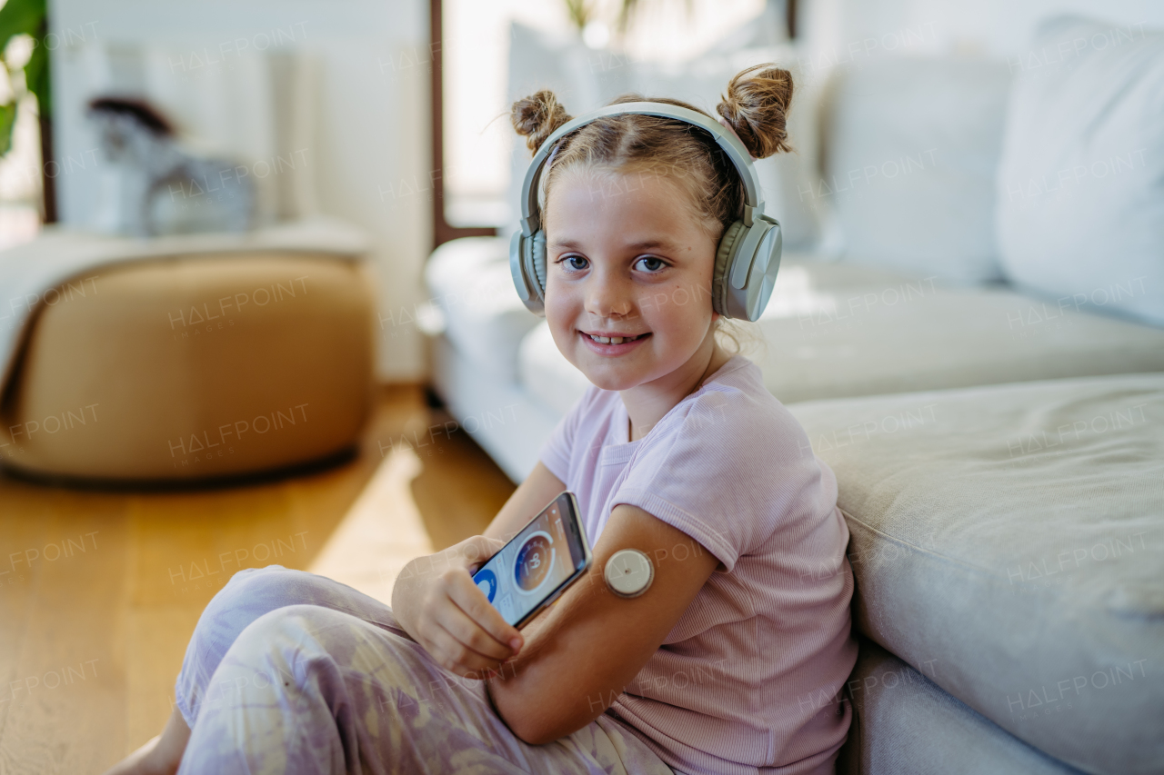 Girl with diabetes using continuous glucose monitor. Girl connecting CGM to a smartphone to monitor her blood sugar levels in real time.