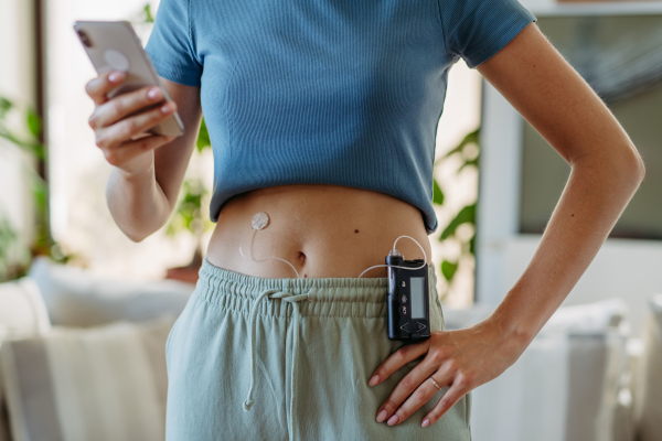 Close up of diabetic woman with insulin pump. Young woman with diabetes at home.