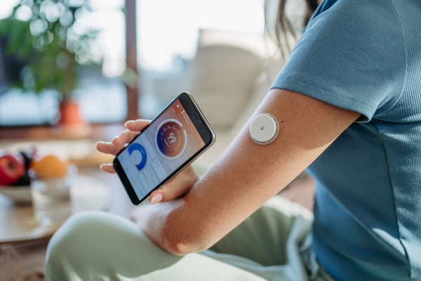 Close up of woman with diabetes using continuous glucose monitor. Diabetic woman connecting CGM to a smartphone to monitor her blood sugar levels in real time.