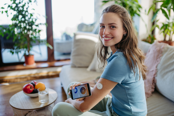 Woman with diabetes using continuous glucose monitor. Diabetic woman connecting CGM to a smartphone to monitor her blood sugar levels in real time.