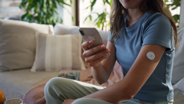 Woman with diabetes using continuous glucose monitor. Diabetic woman connecting CGM to a smartphone to monitor her blood sugar levels in real time.