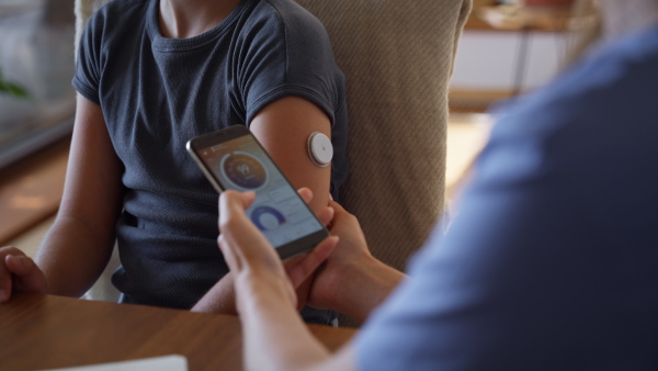 Girl with diabetes checking blood glucose level at home using continuous glucose monitor. Girl's mother connects CGM to a smartphone to monitor her blood sugar levels in real time.