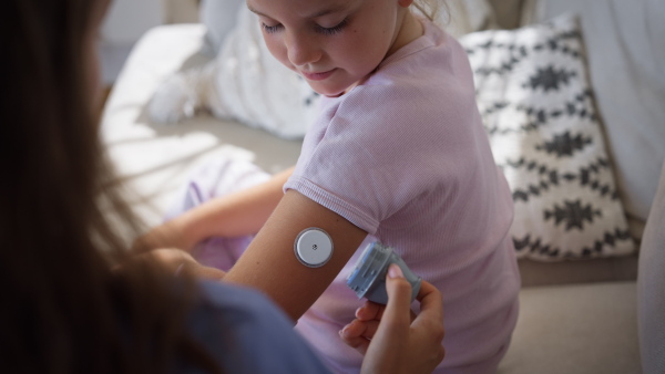 Nurse applying a continuous glucose monitor sensor to the arm of a diabetic girl. CGM device making life of school girl easier, helping manage his illness and focus on other activities.