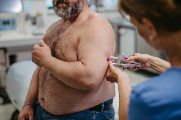 Female doctor measuring the body fat of overweight patient using a caliper. Obesity affecting middle-aged men's health. Concept of health risks of overwight and obesity.