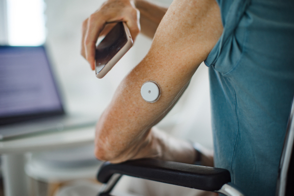 Diabetic senior man checking blood glucose level at home using continuous glucose monitor. Elderly man connecting his CGM with smarphone to see blood sugar levels in real time.