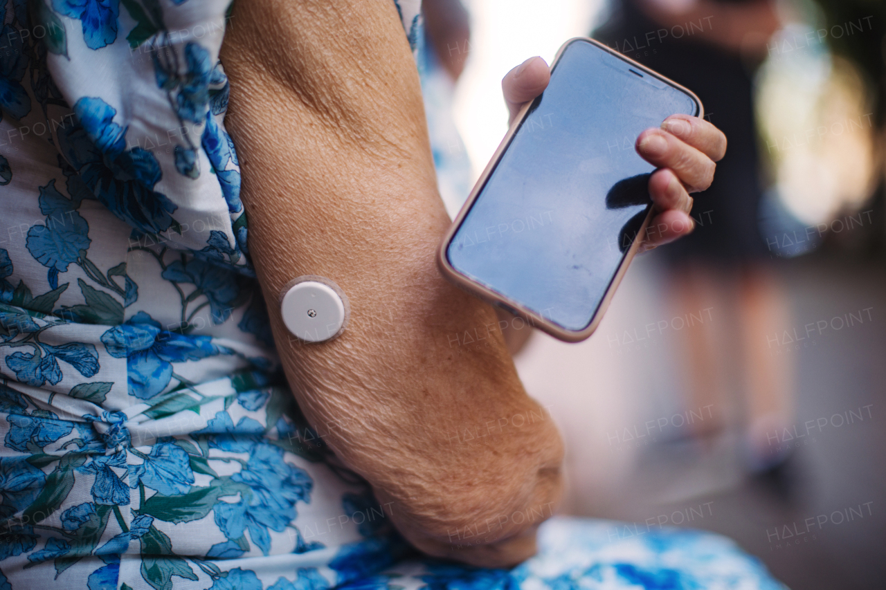 Close up of continuous glucose monitor sensor on arm connecting with smartphone. Diabetic senior woman using continuous glucose monitor to check blood sugar level.