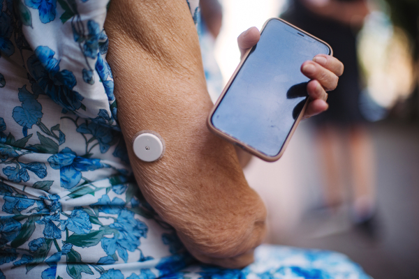 Close up of continuous glucose monitor sensor on arm connecting with smartphone. Diabetic senior woman using continuous glucose monitor to check blood sugar level.