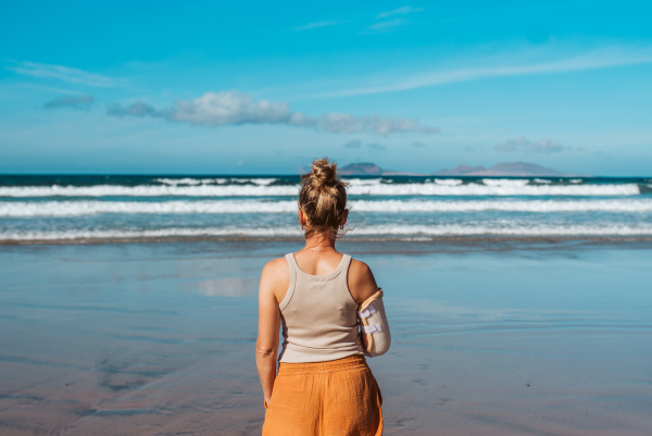 Rear view of beautiful woman with broken arm on beach. Arm cast, injured during family vacation in holiday resort. Concept of beach summer vacation.