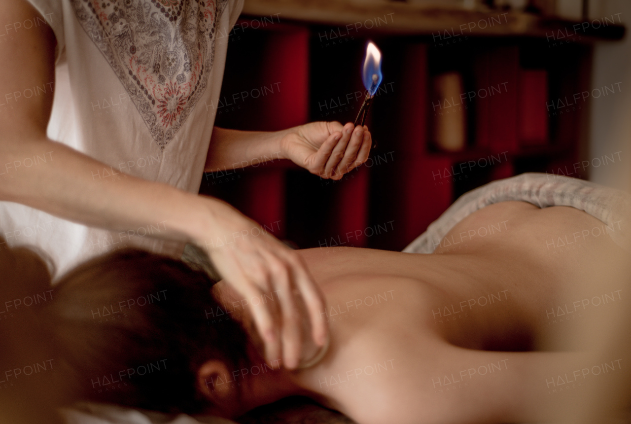 A detail of an acupuncture therapist placing a glass globe in a fire cupping procedure, chinese medicine.