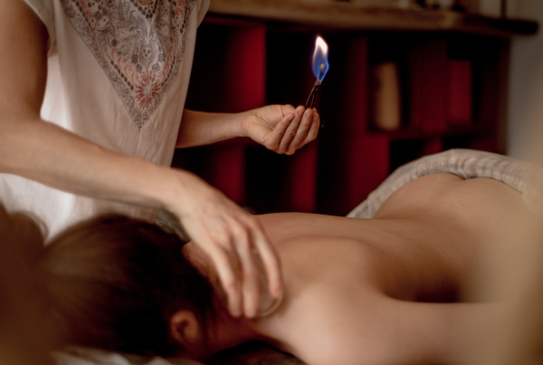 A detail of an acupuncture therapist placing a glass globe in a fire cupping procedure, chinese medicine.