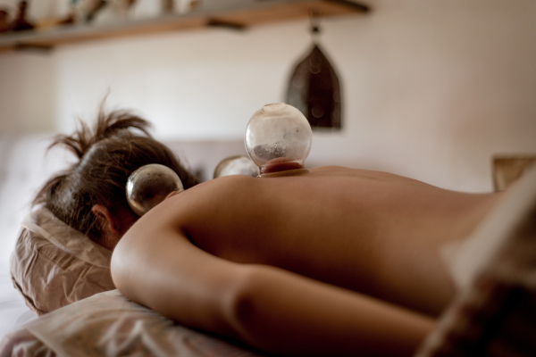 A relaxed young woman receiving cupping treatment on back, traditional chinese medicine.