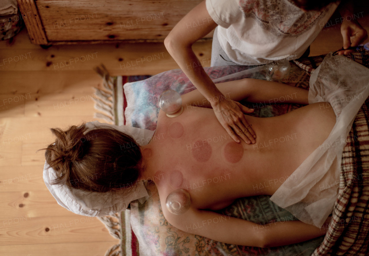 A high angle view of relaxed young woman receiving cupping treatment on back, traditional chinese medicine.